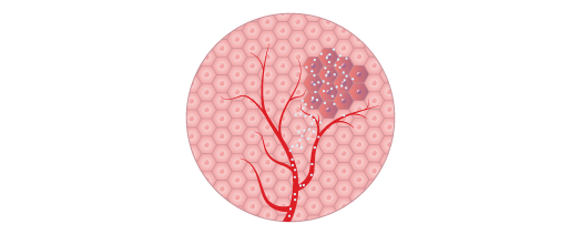 Tumors release chemicals to induce the formation of blood vessels around them, so their fast-dividing cancer cells never run out of “food”(oxygen and nutrients). Some targeted therapy can interfere with this process to starve the tumor of the fuel that ne