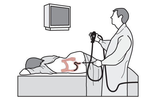 You may experience colic as the colonoscope is inserted. Try to inhale slowly and deeply through your mouth as the colonoscope is pressed forward, this should help. You can also have a colonoscopy under sedation or general anesthesia.