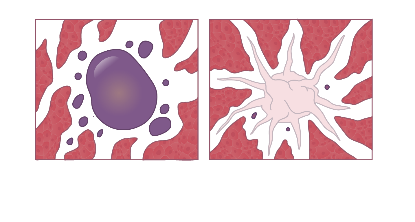 CISTO vs TUMOR MALIGNO